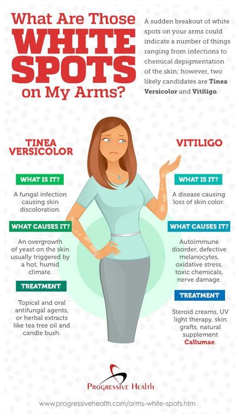 Natural Ways To Get Rid Of White Spots On Skin Vitiligo Skin Spots