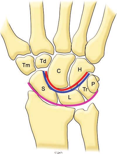 Normal Anatomy Of The Carpal Bones Diagram Of The Wrist Frontal View