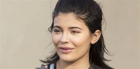 Kylie Jenners Lip Injections May Have Gone Overboard