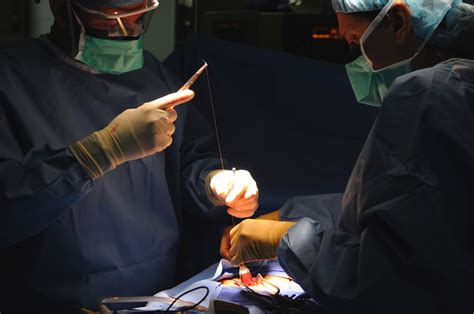 Surgery For Hiatal Hernia General Center