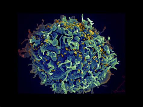 Hiv Potential Hiv Cure Phase I Trial Gets Fda Green Light Human