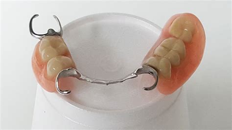 Partial Dentures In Mundelein Il Markiewicz Dentistry