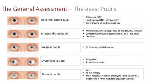 Pupil Assessment Lopianti