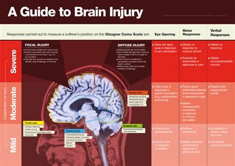 Brain Injury Compensation Head Injury Claims Bbk Solicitors