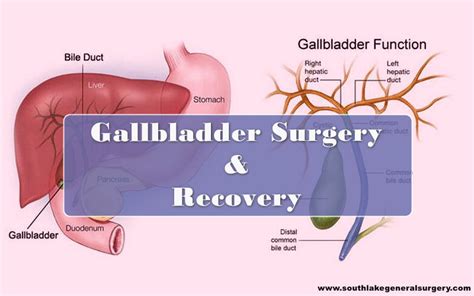 Gallbladder Surgery And Recovery Time Archives Southlake General Surgery