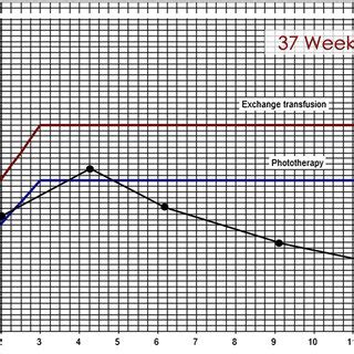 Neonatal introduction an exchange transfusion involves removing aliquots of patient blood and replacing with donor blood in going in and out on the exchange transfusion chart. Figure. Trend of bilirubin levels in our baby as per NHS ...
