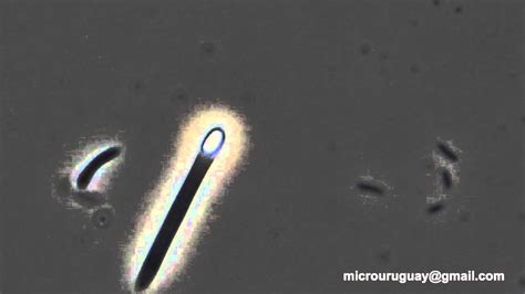 Bacilos Con Esporas Terminales Clostridium Bacillus With Terminals