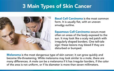 3 Types Of Skin Cancer Kinds And Forms Of Skin Cancers Kulturaupice