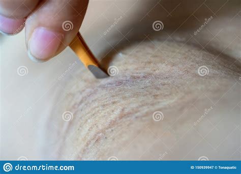 Plucking your armpit hair is not really bad at all but plucking the hair will hurt your skin in the long run. Close Up Hand Of Woman Plucking Armpit Hair Removal Stock ...