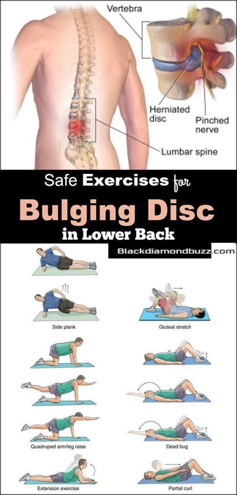 Safe Exercises To Do With A Herniated Disc Workoutwalls