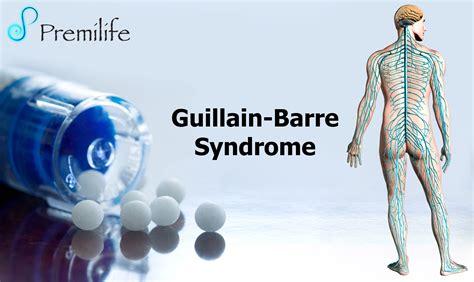 Syndrome De Guillain Barr Comment Se Sont R Tablis Les Patients Hot