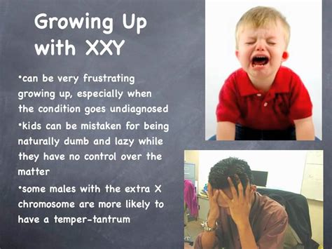 xxxy syndrome