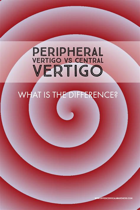 Peripheral Vertigo Vs Central Vertigo What Is The Difference