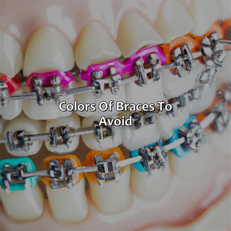 What Color Braces Make Your Teeth Look Whiter