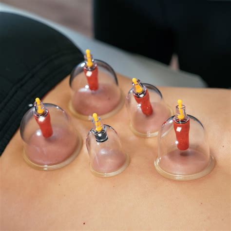 Cupping Strive Pt