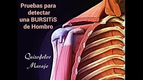 Pruebas Para Detectar Una Bursitis De Hombro Youtube