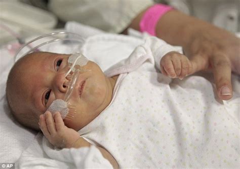 Shes A Little Miracle Baby Born At 24 Weeks Weighing Just 9oz