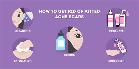 How To Get Rid Of Pitted Acne Scars At Home Skincare Hero