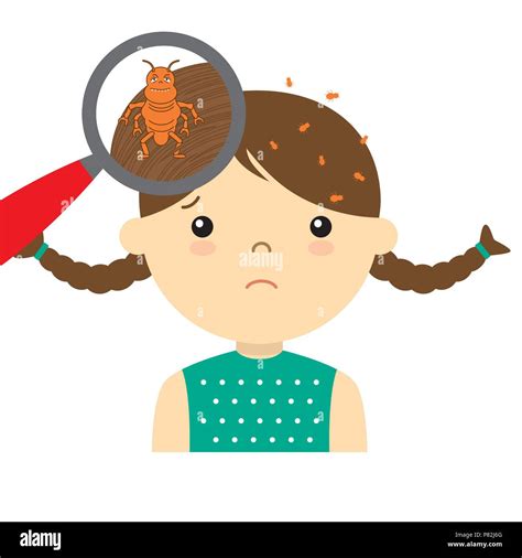 Little Girl With Lice Stock Vector Image And Art Alamy