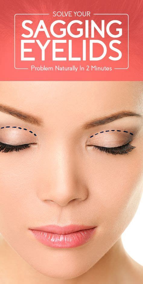 Solve Your Sagging Eyelids Problem Naturally In 2 Minutes Beauty
