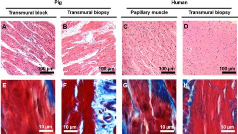 Histological Evaluation Of Pig And Human Ventricular Tissue Specimens