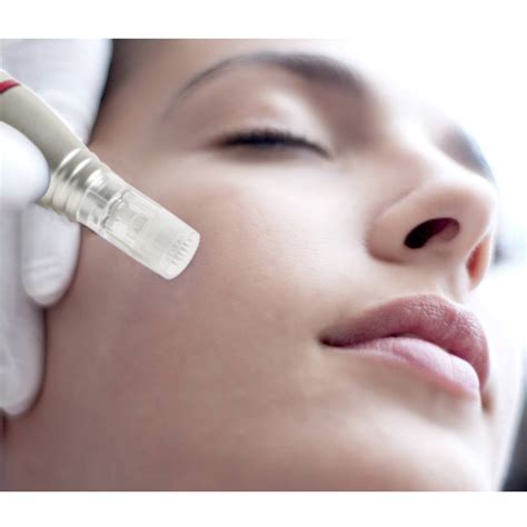 The needle length and amount of pressure applied to the scalp is important. How Scalp Microneedling can Cause Temporary Hair Shedding, and Advantages of Injection Treatment ...