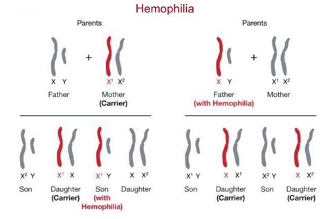 Can A Recessive Trait Be On The Y Chromosome Sex Linked Dominant