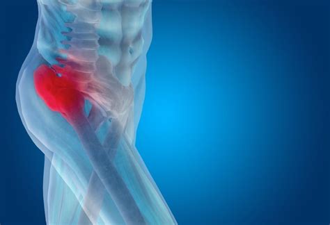 Physiotherapy For Hip Pain Physiomobility