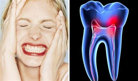How To Fix Sensitive Teeth The 4 Changes To Make Techiazi