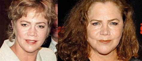 Celebrities Now And Then 42 Pics