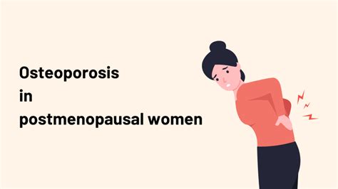 Osteoporosis In Postmenopausal Women Causes Symptoms And Treatment