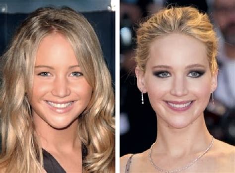 Jennifer Lawrence Before And After Plastic Surgery Boob Nose Teeth