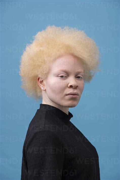 Studio Portrait Of Albino Woman Stock Photo