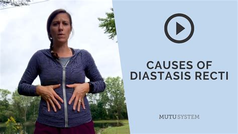 Causes Of Diastasis Recti Visual Explanation Youtube