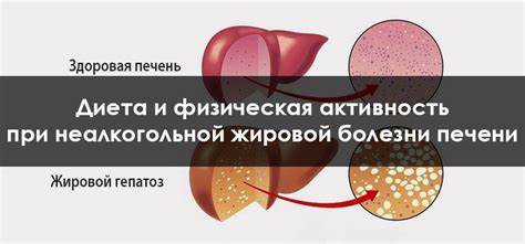 Диета печень увеличена Увеличена Печень Причины И Лечение Диета — Похудение Диета Правильное Увеличена Печень Причины И Лечение Диета — Похудение Диета Правильное Диета печень увеличена