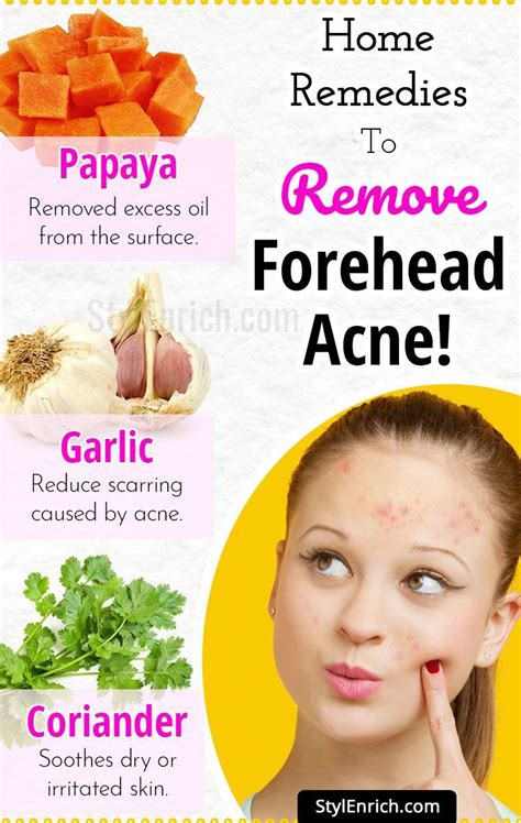 Home Remedies To Remove Forehead Acne Forehead Acne Skin Care Acne