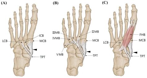 Posterior Tibial Tendon Insertion The Best Porn Website