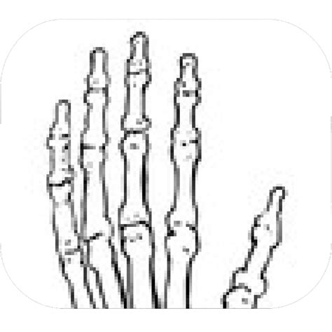 Human Bones Drawing Free Download On Clipartmag