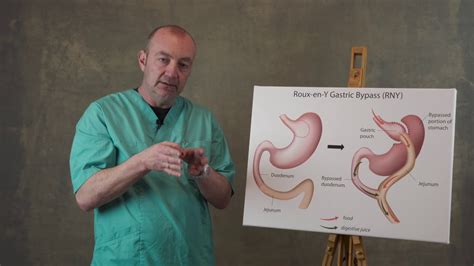 Gastric Bypass Youtube