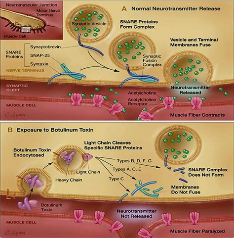 Botulism is caused by nerve toxins made by clostridium botulinum bacteria. Botulism: A rare but deadly disease: How did clostridium ...