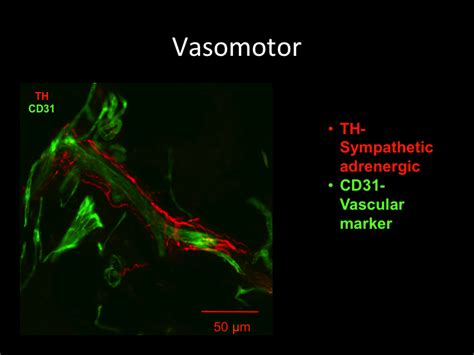 Dysautonomia International Research Grant Vasomotor Neuropathy In Pots