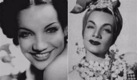 11 Classic Hollywood Stars Who Had Plastic Surgery Vintage News Daily