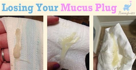 Mucus Plug Color Chart