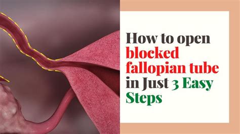 How To Open Blocked Fallopian Tube In Just Easy Steps Video Video