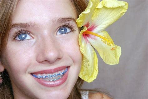 Braces On Pinterest Rainbow Lips Face Off And Fashion