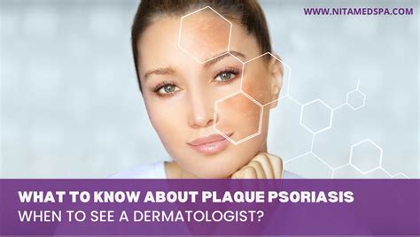 What To Know About And Treatment For Plaque Psoriasis