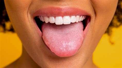 Normal Tongue Appearance