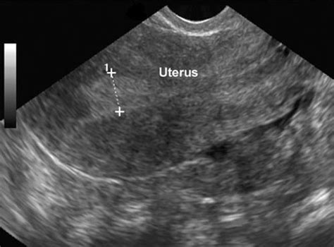 To prepare for an ultrasound, your cat should not eat for 12 hours, but water should be available as the urinary bladder is best visualised if it's full of urine. What is a ultrasound scan & how much does it cost? |The ...