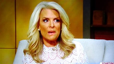 Janice Dean Cosmetic Procedure Went Horribly Bad 4 24 17