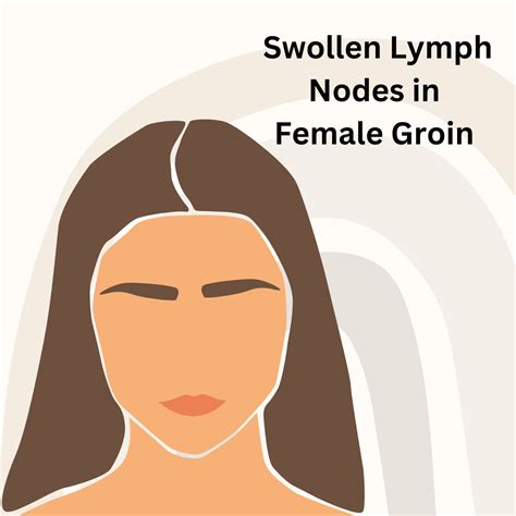 Swollen Lymph Nodes In The Groin In Females Young Earth Sanctuary